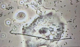 病原菌大多数属于（病原菌大多数属于专性厌氧菌）