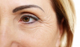 如何快速去除鱼尾纹 如何快速去除鱼尾纹小妙招