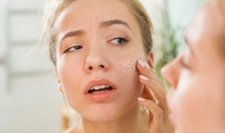 脸太干了怎么补水 脸太干了怎么补水快