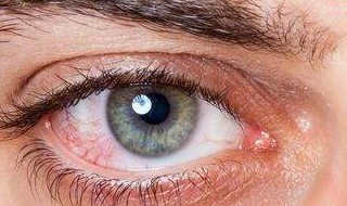 眼睛里有红血丝怎么消除 眼睛里有红血丝怎么消除掉