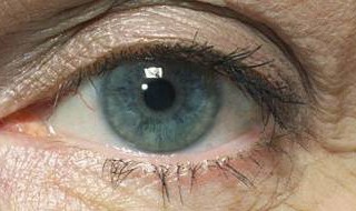 眼部皮肤问题要如何改善 眼部皮肤问题专业知识