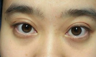 黑眼袋很重怎么办（黑眼袋很重怎么办）