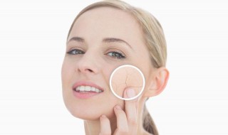 脸干起皮紧绷怎么办（脸干起皮紧绷怎么办啊）