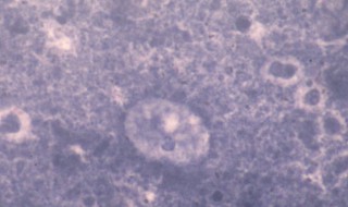 弓形虫怎么杀死（杀死弓形虫的方法）