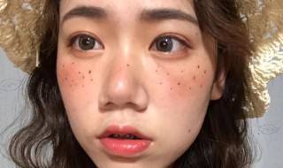 脸上有雀斑怎么办呢 脸上有雀斑怎么办呢男生