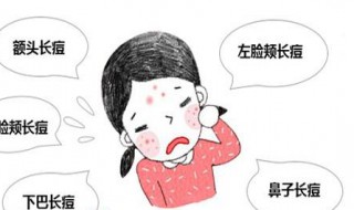 痤疮和青春痘的区别（痤疮和青春痘的区别图片）