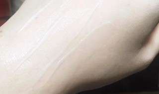 如何祛除痘痘和痘印 如何祛除痘痘和痘印和痘印