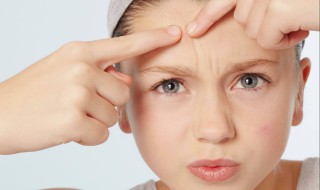 痘痘冒黄头说明什么（痘痘为什么冒黄头）