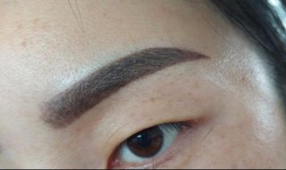 纹眉后周围皮肤变白 纹眉后周围皮肤变白有什么药