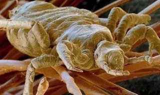 怎么去虱子（怎么去虱子和虱子卵）