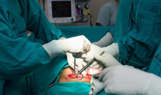 剖腹产后坐月子吃什么好 剖腹产后坐月子吃什么好呢