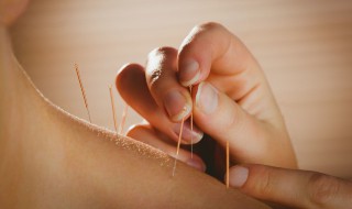 平衡针灸是什么（什么叫平衡针灸）
