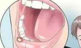 嘴上起疮怎么快速消除(嘴上起泡怎么快速消除)