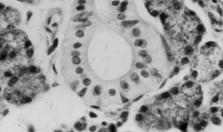 混合性腺泡由什么组成（混合性腺泡图片）