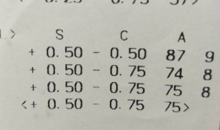 验光单怎么看是多少度 验光单怎么看的