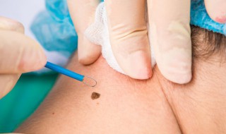 朱砂痣指什么 白日光朱砂痣指什么