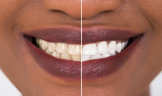 如何掌握两个洁白牙齿的小技巧 如何掌握两个洁白牙齿的小技巧视频