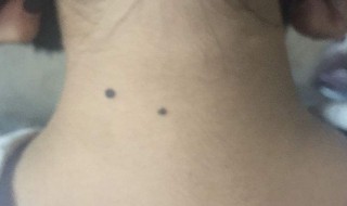 苦情痣是什么意思呢 苦情痣由来