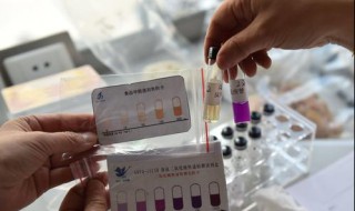 火碱吃了一点点怎么办（火碱不小心吃着一点点,给有问题）