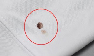 清洗血渍的最佳方法 清洗血渍的最佳方法是什么