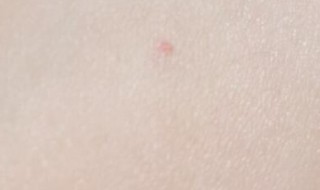 朱砂痣的位置（朱砂痣的位置含义）