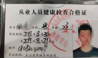 办健康证需要检查什么（上班办健康证需要检查什么）