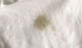 白色衣服有油清洁小妙招（白色衣服有油怎么洗白小妙招）