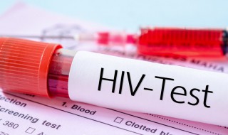 如何检测艾滋病 如何检测艾滋病试纸