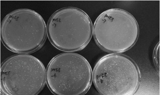 培养基的配制方法 培养基的配制方法需要注意什么