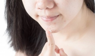 去痘痘印的小妙招（去痘痘痘印的小妙招）