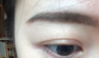 麦粒肿到底怎么快速消除（麦粒肿如何快速消除）