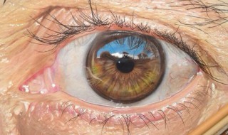 如何去除眼部皱纹 如何去除眼部皱纹科学去皱法