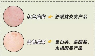 怎样去除痘印（怎样去除痘印留下的黑色素）