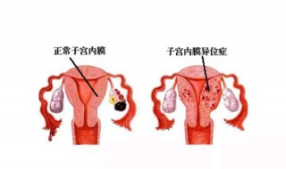 宫颈在哪个位置 宫颈在哪个位置图片