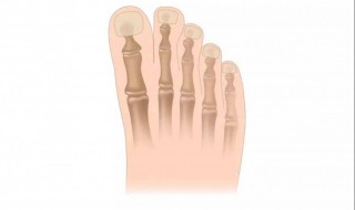 趾骨是哪个位置 趾骨是哪个位置图解
