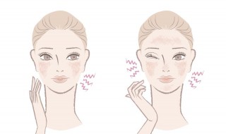 皮肤油性怎么改善 皮肤油性怎么改善脸部