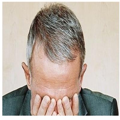 头发白是什么原因