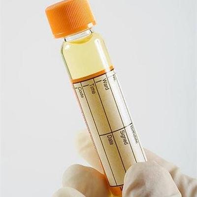 外伤性血尿是什么