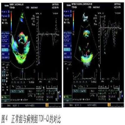 左心室舒张功能减低怎么办