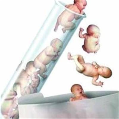 试管婴儿的条件是什么