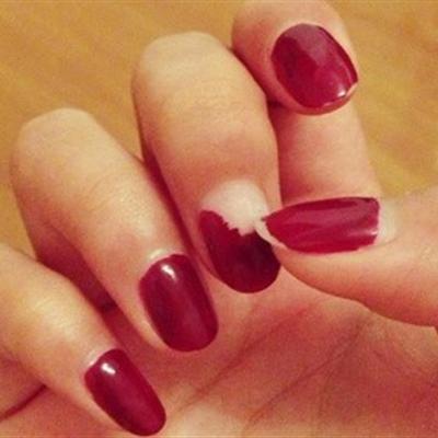 指甲发紫怎么回事