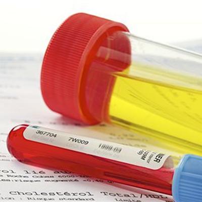 总想小便是怎么回事