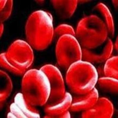  镜下血尿需要治疗吗