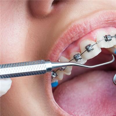 牙齿修复要多少钱