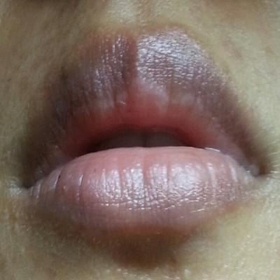 嘴巴周围发黑怎么办