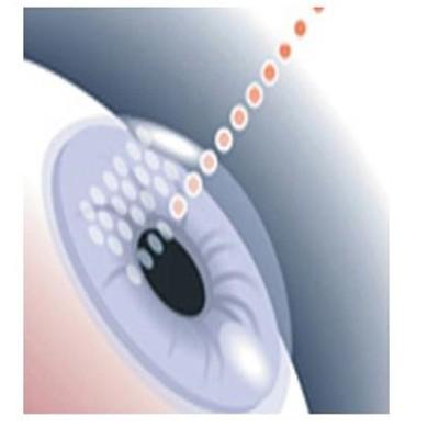 超声波去眼袋多少钱