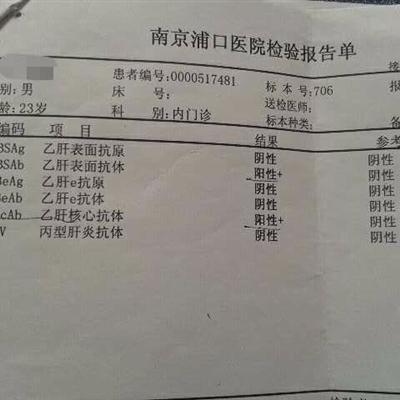 肝功能五项是什么呢
