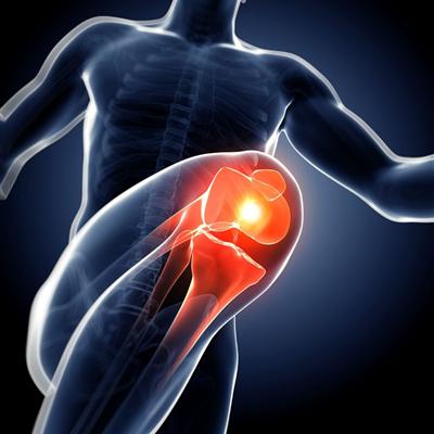 痛风的原因有哪些