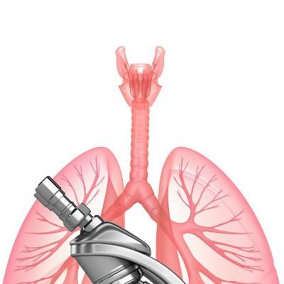 肺癌晚期吃什么食物好