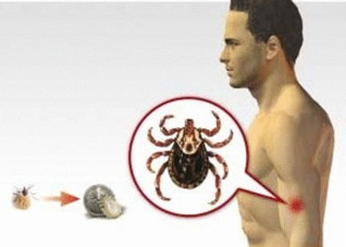 羌虫病要怎么办